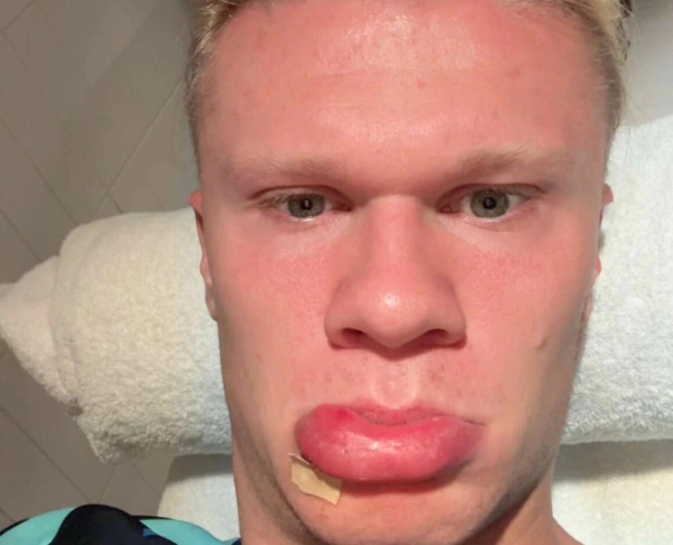 上咪咕独家, 在那些荒唐